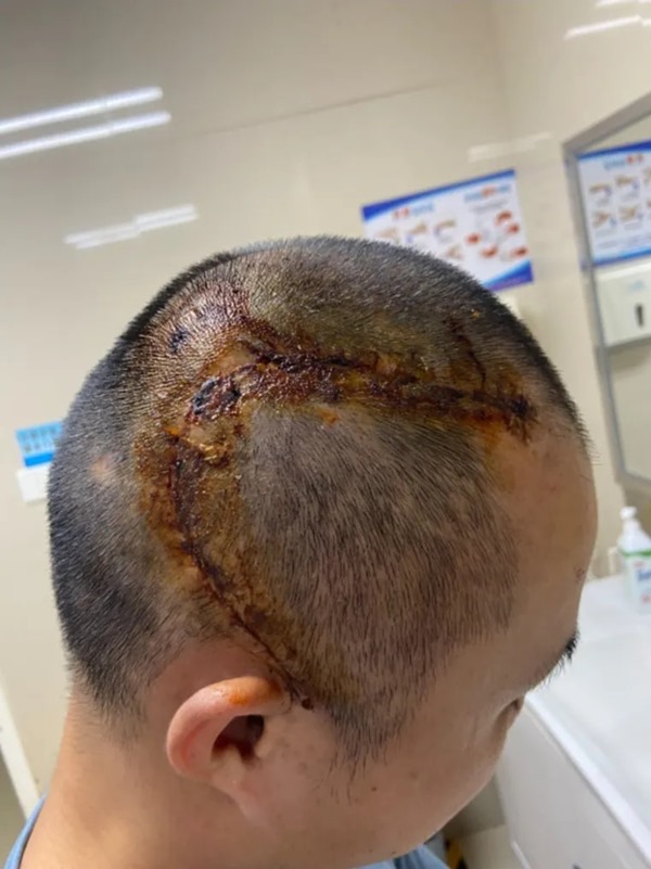 1722307274778629.jpg 640_wx_fmt=jpeg&tp=webp&wxfrom=5&wx_lazy=1&wx_co=1.jpg