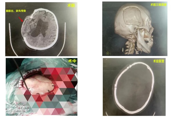 1722307431768502.jpg 640_wx_fmt=jpeg&from=appmsg&tp=webp&wxfrom=5&wx_lazy=1&wx_co=1.jpg