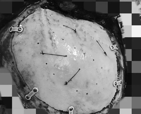 1722307725662215.jpg 640_wx_fmt=jpeg&tp=webp&wxfrom=5&wx_lazy=1&wx_co=1 (6).jpg