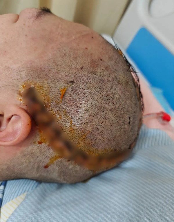 1722307935255387.jpg 640_wx_fmt=jpeg&tp=webp&wxfrom=5&wx_lazy=1&wx_co=1.jpg