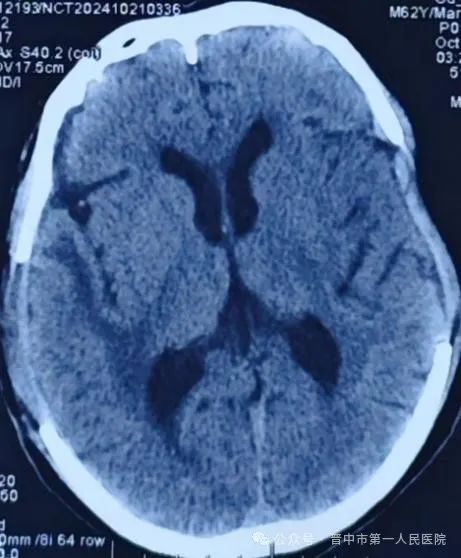 1744860731719602.jpg 640_wx_fmt=jpeg&from=appmsg&wx_&tp=webp&wxfrom=10005&wx_lazy=1&wx_co=1.jpg